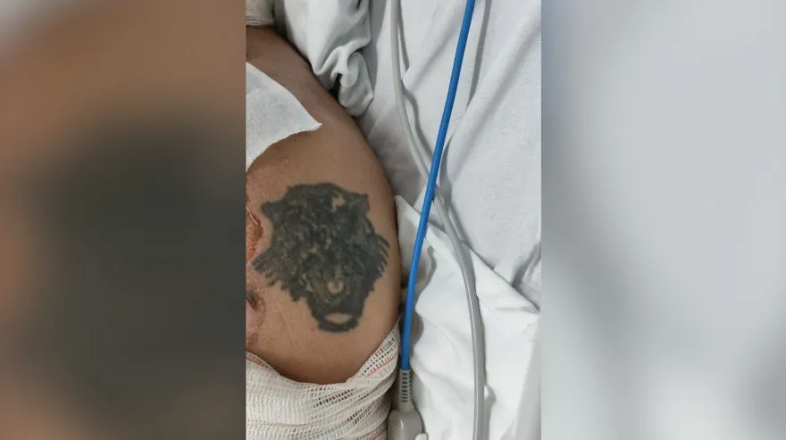 HUOP pede ajuda para identificar paciente com queimaduras graves. Ele seria morador de Marechal Rondon