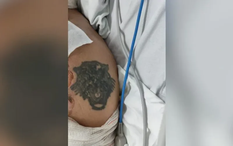 HUOP pede ajuda para identificar paciente com queimaduras graves. Ele seria morador de Marechal Rondon