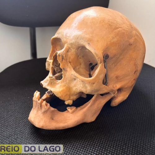 Crânio humano é encontrado em armário de ex-coletor da Associação dos Agentes Ambientais de Santa Helena