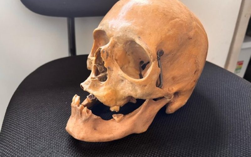 Crânio humano é encontrado em armário de ex-coletor da Associação dos Agentes Ambientais de Santa Helena
