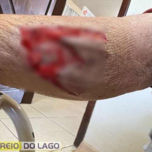 Cão feroz ataca moradores em Moreninha, Santa Helena