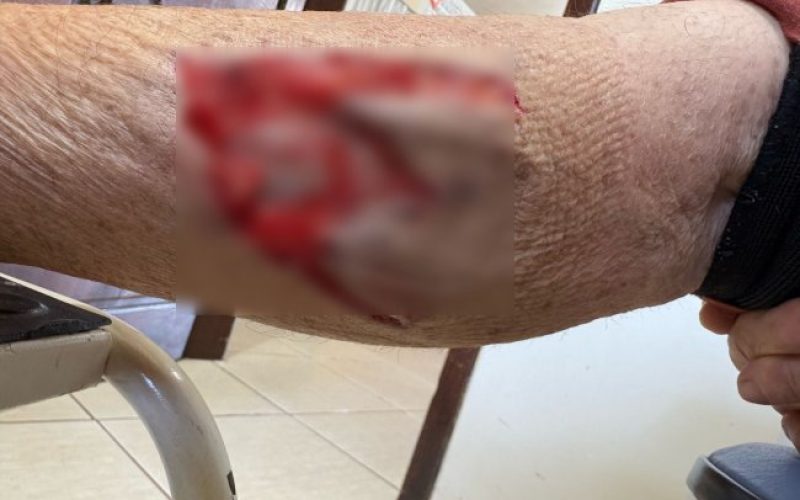 Cão feroz ataca moradores em Moreninha, Santa Helena